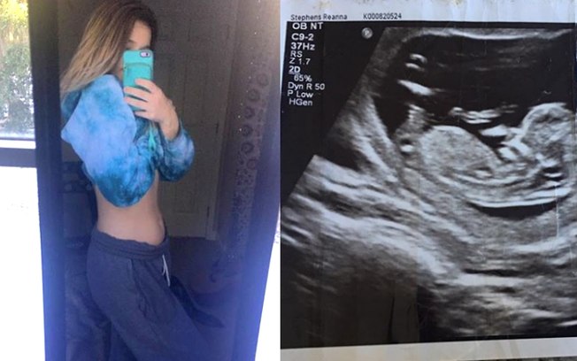 Jovem Reanna Stephens compartilhou fotos da sua barriga de grávida no Instagram%2C mas nem todos acreditam na história