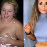 Após jornada de dez anos, mulher perde quase 40 kg e mostra transformação na web